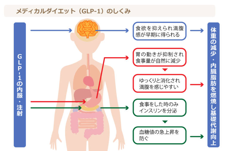 GLP-1 RAはどのように摂取されますか?